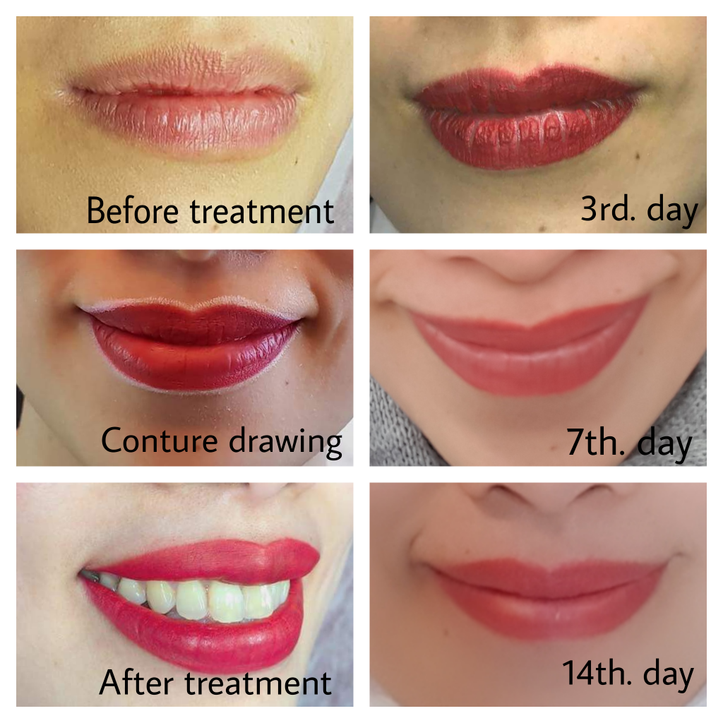 Lippen Pigmentierung Permanent Make Up Abheilung nach 7 Wochen